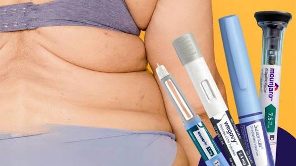 Especialista alerta sobre riesgos de usar inyecciones para adelgazar sin control médico